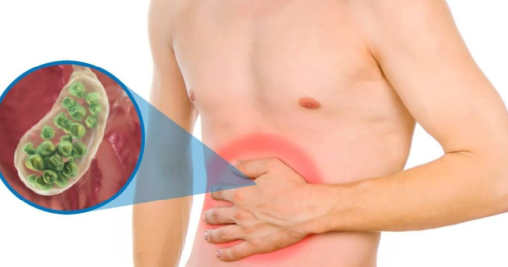 How serious is it to have stones in the gallbladder? Five foods that cause this condition