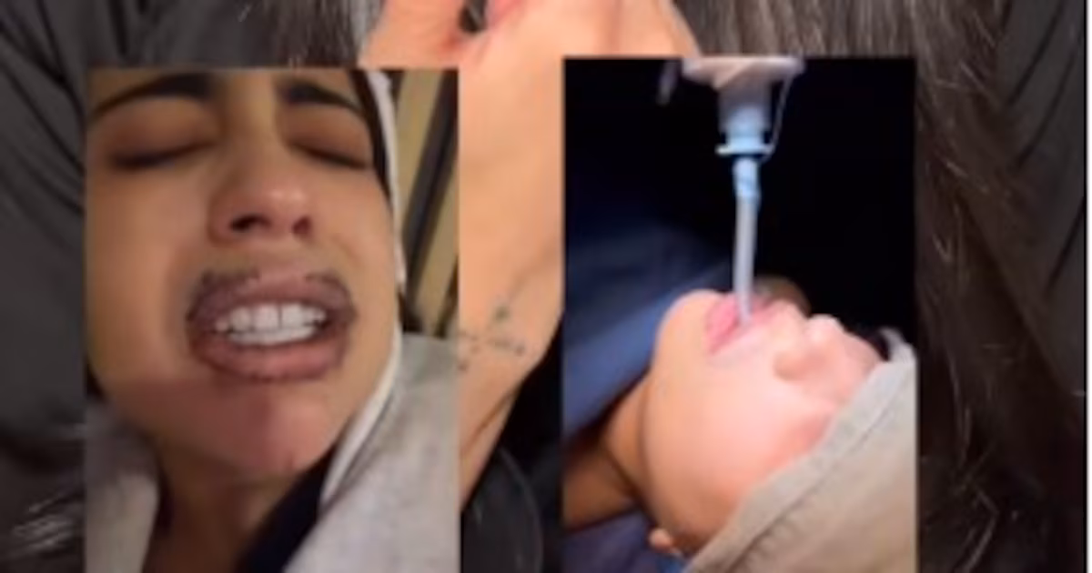 “They injected me with silicone with industrial oil”: woman reports serious case after aesthetic procedure in Colombia